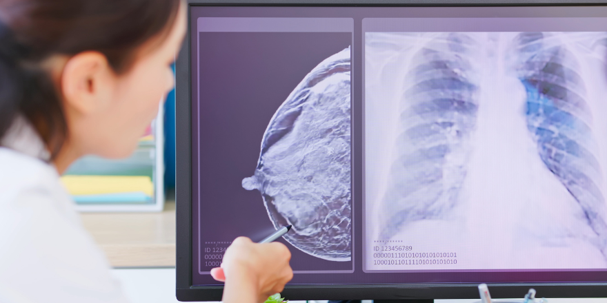 mammography mammography